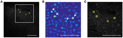 Particle Tracking Facilitates Real Time Capable Motion Correction in 2D or 3D Two-Photon Imaging of Neuronal Activity